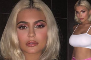 Kylie Jenner puts Lip fillers Back In!